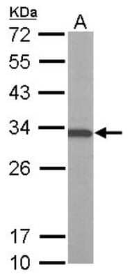 ATP6V1E1 Antibody (NBP2-15519): Novus Biologicals