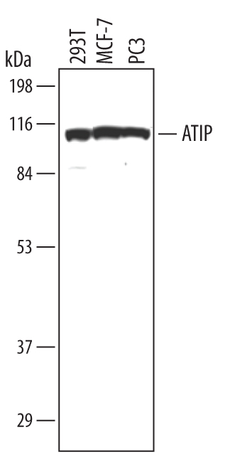 Western blot shows lysates of 293T human embryonic kidney cell line, MCF-7 human breast cancer cell line and PC-3 human prostate cancer cell line. PVDF membrane was probed with 1 µg/mL of Human ATRIP Antigen Affinity-purified Polyclonal Antibody (Catalog # AF1579) followed by HRP-conjugated Anti-Sheep IgG Secondary Antibody (Catalog # HAF016). A specific band was detected for ATRIP at approximately 100 kDa (as indicated). This experiment was conducted under reducing conditions and using Immunoblot Buffer Group 1.