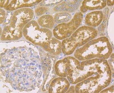 Immunohistochemistry-Paraffin: Acetyl-CoA Carboxylase alpha/ACACA Antibody [NBP2-89114] - Analysis of paraffin-embedded human kidney tissue using anti-Acetyl CoA Carboxylase 1 (ACC1) antibody. The section was pre-treated using heat mediated antigen retrieval with Tris-EDTA buffer (pH 8.0-8.4) for 20 minutes.The tissues were blocked in 5% BSA for 30 minutes at room temperature, washed with ddH2O and PBS, and then probed with the antibody at 1/200 dilution, for 30 minutes at room temperature and detected using an HRP conjugated compact polymer system. DAB was used as the chrogen. Counter stained with hematoxylin and mounted with DPX.