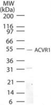 Western Blot: Activin RIA/ALK-2/Activin Receptor Type 1 Antibody [NB100-56432] - Analysis of Activin RIA/ALK-2/Activin Receptor Type 1 in mouse kidney lysate using this antibody at 5 ug/ml