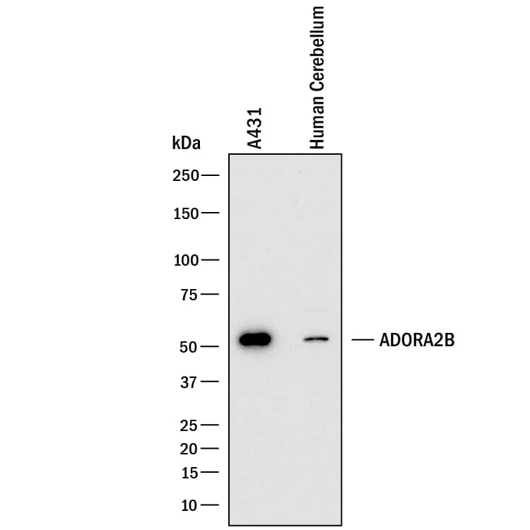 Western blot shows lysates of A431 human epithelial carcinoma cell line and human cerebeullum tissue. PVDF membrane was probed with 2 µg/mL of Mouse Anti-Human Adenosine A2b R Monoclonal Antibody (Catalog # MAB10444) followed by HRP-conjugated Anti-Mouse IgG Secondary Antibody (Catalog # HAF018). A specific band was detected for Adenosine A2b R at approximately 52 kDa (as indicated). This experiment was conducted under reducing conditions and using Immunoblot Buffer Group 1.