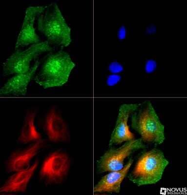 Immunocytochemistry/Immunofluorescence: Adiponectin/Acrp30 Antibody [NB100-65810] - Adiponectin antibody was tested in HeLa cells with Dylight 488 (green). Nuclei and alpha-tubulin were counterstained with DAPI (blue) and Dylight 550 (red). Cytoplasmic, membrane and internal organelle staining was observed.