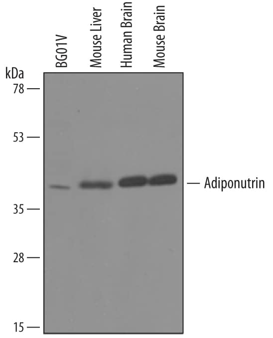Western blot shows lysates of BG01V human embryonic stem cells, mouse liver tissue, human brain tissue, and mouse brain tissue. PVDF membrane was probed with 1 µg/mL of Sheep Anti-Mouse Adiponutrin/PNPLA3 Antigen Affinity-purified Polyclonal Antibody (Catalog # AF5179) followed by HRP-conjugated Anti-Sheep IgG Secondary Antibody (Catalog # HAF016). A specific band was detected for Adiponutrin/PNPLA3 at approximately 45 kDa (as indicated). This experiment was conducted under reducing conditions and using Immunoblot Buffer Group 8.