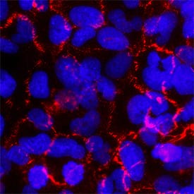 Afadin/AF-6 was detected in immersion fixed BEAS2B human bronchial epithelial cell line using Mouse Anti-Human Afadin/AF-6 Monoclonal Antibody (Catalog # MAB78291) at 25 µg/mL for 3 hours at room temperature. Cells were stained using the NorthernLights™ 557-conjugated Anti-Mouse IgG Secondary Antibody (red; Catalog # NL007) and counterstained with DAPI (blue). Specific staining was localized to plasma membrane. View our protocol for Fluorescent ICC Staining of Cells on Coverslips.