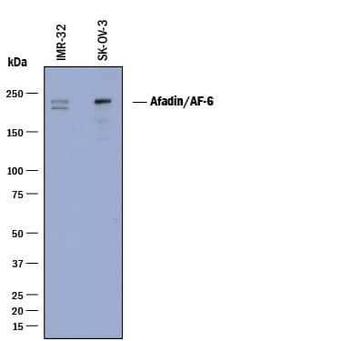 Western blot shows lysates of IMR-32 human neuroblastoma cell line and SK-OV-3 human ovarian adenocarcinoma cell line. PVDF membrane was probed with 0.5 µg/mL of Mouse Anti-Human Afadin/AF-6 Monoclonal Antibody (Catalog # MAB78291) followed by HRP-conjugated Anti-Mouse IgG Secondary Antibody (Catalog # HAF018). A specific band was detected for Afadin/AF-6 at approximately 200-240 kDa (as indicated). This experiment was conducted under reducing conditions and using Immunoblot Buffer Group 1.