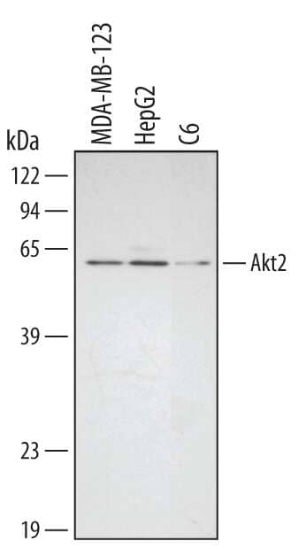 Western blot shows lysates of MBA-MB-123 human breast cancer cell line, HepG2 human hepatocellular carcinoma cell line, and C6 rat glioma cell line. PVDF membrane was probed with 0.2 µg/mL Human/Mouse/Rat Akt2 Antigen Affinity-purified Polyclonal Antibody (Catalog # AF2315) followed by HRP-conjugated Anti-Rabbit IgG Secondary Antibody (Catalog # HAF008). A specific band for Akt2 was detected at approximately 60 kDa (as indicated). This experiment was conducted under reducing conditions and using Immunoblot Buffer Group 1.