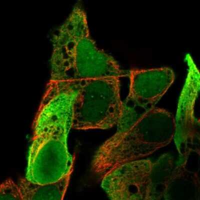 Aldo-keto Reductase 1C1/AKR1C1 Antibody (NBP2-57667): Novus Biologicals