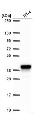 Aldo-keto Reductase 1C1/AKR1C1 Antibody (NBP2-57667): Novus Biologicals