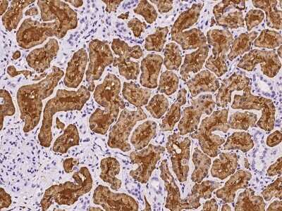 Aldolase B Antibody (NBP2-97911): Novus Biologicals