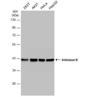 Aldolase B Antibody (NBP2-15344): Novus Biologicals