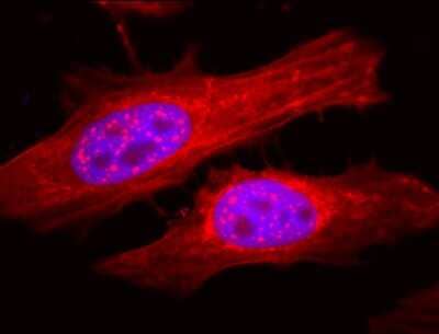 Immunocytochemistry/Immunofluorescence: AlphaB Crystallin/CRYAB Antibody [NB120-13497] - analysis using Rabbit Anti-Alpha B Crystallin Polyclonal Antibody. Tissue: Heat Shocked HeLa Cells. Species: Human. Fixation: 2% Formaldehyde for 20 min at RT. Primary Antibody: Rabbit Anti-Alpha B Crystallin Polyclonal Antibody at 1:120 for 12 hours at 4C. Secondary Antibody: FITC Goat Anti-Rabbit (green) at 1:200 for 2 hours at RT. Counterstain: DAPI (blue) nuclear stain at 1:40000 for 2 hours at RT. Localization: Actin filament bundles. Nuclear splicing speckles. Exosomes. Magnification: 20x. Heat Shocked at 42C for 1h.