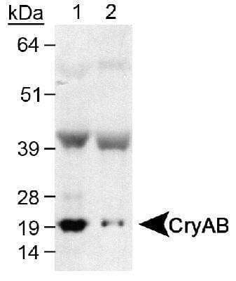 Western Blot: AlphaB Crystallin/CRYAB Antibody [NB100-2519] - Detection of CryAB using NB 100-2519 (0.5ug/ml). Lane 1: Human skeletal muscle Lane 2: Mouse skeletal muscle.
