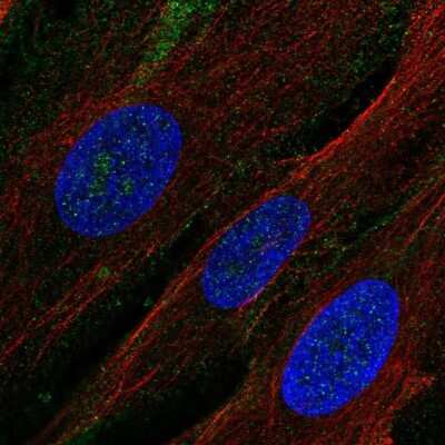Immunocytochemistry/Immunofluorescence: Aminopeptidase N/CD13 Antibody [NBP2-33855] - Staining of human cell line BJ shows localization to plasma membrane. Antibody staining is shown in green.