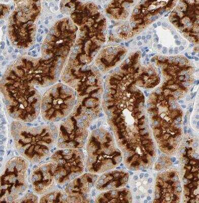 Immunohistochemistry-Paraffin: Aminopeptidase N/CD13 Antibody [NBP2-33855] - Staining of human kidney shows strong membranous positivity in cells in tubules.