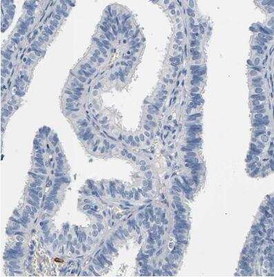 Immunohistochemistry-Paraffin: Aminopeptidase N/CD13 Antibody [NBP2-33855] - Staining of human fallopian tube shows no positivity in glandular cells as expected.