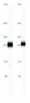 Simple Western: Aminopeptidase N/CD13 Antibody [NBP2-33855] - Simple Western lane view shows a specific band for Aminopeptidase N/CD13 in 0.2 mg/ml of HEL (left) and H. Kidney (right) lysate(s). This experiment was performed under reducing conditions using the 12-230 kDa separation systems.