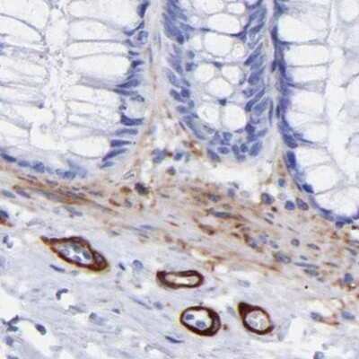 Immunohistochemistry-Paraffin: Amphiphysin/AMPH Antibody [NBP1-86033] - Staining of human colon.
