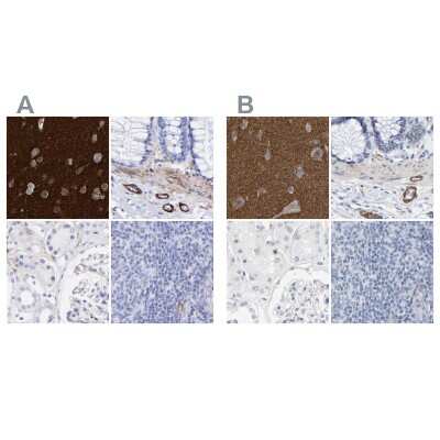 Western Blot: Amphiphysin/AMPH Antibody [NBP1-86033] - Staining of human cerebral cortex, colon, kidney and tonsil using Anti-AMPH antibody NBP1-86033 (A) shows similar protein distribution across tissues to independent antibody NBP1-87561 (B).