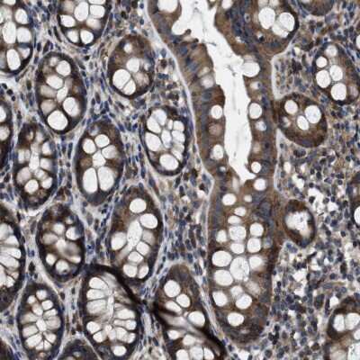 Immunohistochemistry-Paraffin: Angiopoietin-1 Antibody [NBP1-90169] - Staining of human rectum shows strong cytoplasmic positivity in glandular cells.