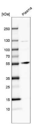 Western Blot: Angiopoietin-1 Antibody [NBP1-90169] - Analysis in human plasma.