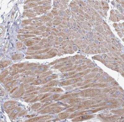 Immunohistochemistry-Paraffin: Angiopoietin-like Protein 5/ANGPTL5 Antibody [NBP1-85870] - Staining of human heart muscle shows moderate cytoplasmic positivity in myocytes.