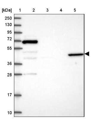 Western Blot: Angiopoietin-like Protein 5/ANGPTL5 Antibody [NBP1-85870] - Lane 1: Marker  [kDa] 250, 130, 95, 72, 55, 36, 28, 17, 10.  Lane 2: Human cell line RT-4.  Lane 3: Human cell line U-251MG sp.  Lane 4: Human plasma (IgG/HSA depleted).  Lane 5: Human liver tissue