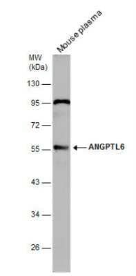 Western Blot: Angiopoietin-like Protein 6/ANGPTL6 Antibody [NBP2-15394] - Mouse tissue extract (50 ug) was separated by 10% SDS-PAGE, and the membrane was blotted with ANGPTL6 antibody diluted at 1:1000. The signal was developed with Trident ECL plus-Enhanced.