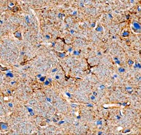 Immunohistochemistry Angiopoietin-like Protein 7/ANGPTL7 Antibody (538401)