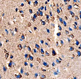 Immunohistochemistry Angiopoietin-like Protein 7/ANGPTL7 Antibody (538401)