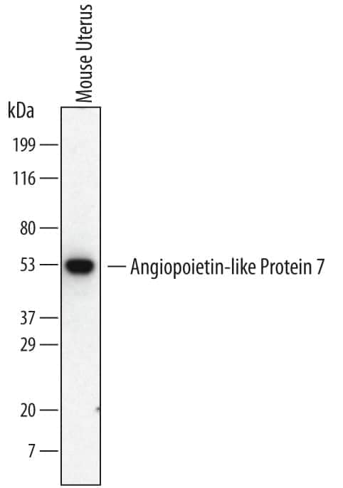 Western Blot Angiopoietin-like Protein 7/ANGPTL7 Antibody (538401)