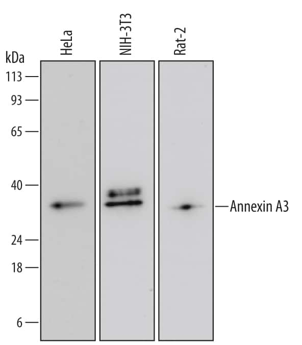 Western blot shows lysates of HeLa human cervical epithelial carcinoma cell line, NIH-3T3 mouse embryonic fibroblast cell line, and Rat-2 rat embryonic fibroblast cell line. PVDF Membrane was probed with 0.1 µg/mL of Mouse Anti-Human Annexin A3 Monoclonal Antibody (Catalog # MAB4855) followed by HRP-conjugated Anti-Mouse IgG Secondary Antibody (Catalog # HAF007). A specific band was detected for Annexin A3 at approximately 36 kDa (as indicated). This experiment was conducted under reducing conditions and using Immunoblot Buffer Group 2.