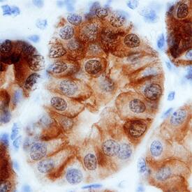 Annexin A4 was detected in immersion fixed paraffin-embedded sections of human kidney using Mouse Anti-Human Annexin A4 Monoclonal Antibody (Catalog # MAB4146) at 15 µg/mL overnight at 4 °C. Before incubation with the primary antibody, tissue was subjected to heat-induced epitope retrieval using Antigen Retrieval Reagent-Basic (Catalog # CTS013). Tissue was stained using the Anti-Mouse HRP-DAB Cell & Tissue Staining Kit (brown; Catalog # CTS002) and counterstained with hematoxylin (blue). Specific staining was localized to cell membranes and the nuclear envelope of epithelial cells in convoluted tubules. View our protocol for Chromogenic IHC Staining of Paraffin-embedded Tissue Sections.