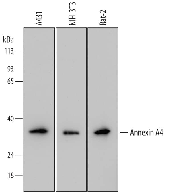 Western blot shows lysates of A431 human epithelial carcinoma cell line, NIH-3T3 mouse embryonic fibroblast cell line, and Rat-2 rat embryonic fibroblast cell line. PVDF membrane was probed with 0.1 µg/mL of Mouse Anti-Human Annexin A4 Monoclonal Antibody (Catalog # MAB4146) followed by HRP-conjugated Anti-Mouse IgG Secondary Antibody (Catalog # HAF007). A specific band was detected for Annexin A4 at approximately 36 kDa (as indicated). This experiment was conducted under reducing conditions and using Immunoblot Buffer Group 2.