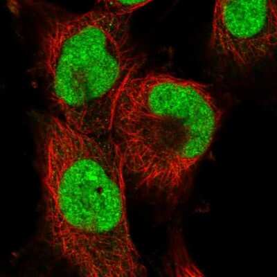 Apc11 Antibody (NBP1-90139): Novus Biologicals