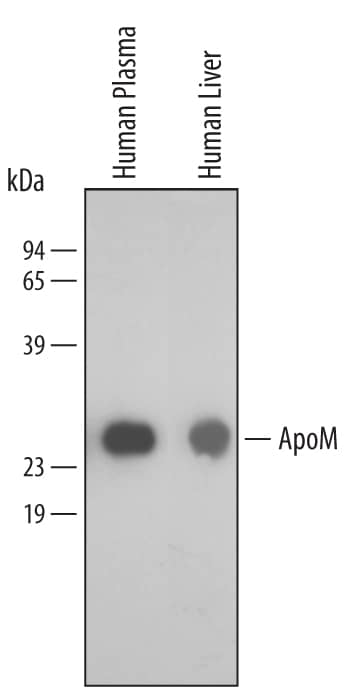 Western Blot Apolipoprotein M/ApoM Antibody