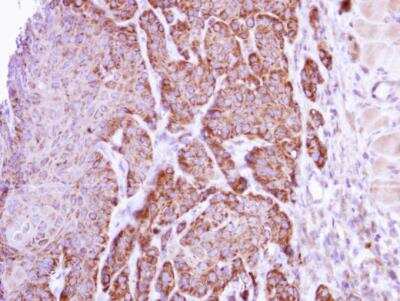 Immunohistochemistry-Paraffin: Arginase 1/ARG1/liver Arginase Antibody [NBP1-32731] -  Cal27 xenograft, using arginase I antibody at 1:500 dilution.