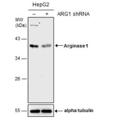 Western Blot: Arginase 1/ARG1/liver Arginase Antibody [NBP1-32731] - Non-transfected (-) and transfected (+) HepG2 whole cell extracts (30 ug) were separated by 10% SDS-PAGE, and the membrane was blotted with Arginase 1 antibody.