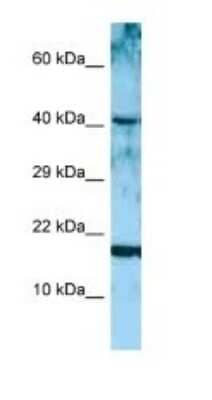Western Blot: Artemin Antibody [NBP1-98555] - Titration: 1.0 ug/ml Positive Control: MCF7 Whole Cell.