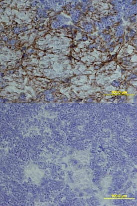 Artemin was detected in perfusion fixed frozen sections of mouse brain using Goat Anti-Mouse Artemin Biotinylated Antigen Affinity-purified Polyclonal Antibody (Catalog # BAF1085) at 15 µg/mL overnight at 4 °C. Tissue was stained using the Anti-Goat HRP-DAB Cell & Tissue Staining Kit (brown; Catalog # CTS008) and counterstained with hematoxylin (blue). Lower panel shows a lack of labeling if primary antibodies are omitted and tissue is stained only with secondary antibody followed by incubation with detection reagents. View our protocol for Chromogenic IHC Staining of Frozen Tissue Sections.