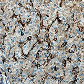 Arylsulfatase B/ARSB was detected in immersion fixed paraffin-embedded sections of human liver using Sheep Anti-Human Arylsulfatase B/ARSB Antigen Affinity-purified Polyclonal Antibody (Catalog # AF4415) at 3 µg/mL overnight at 4 °C. Before incubation with the primary antibody, tissue was subjected to heat-induced epitope retrieval using Antigen Retrieval Reagent-Basic (Catalog # CTS013). Tissue was stained using the Anti-Sheep HRP-DAB Cell & Tissue Staining Kit (brown; Catalog # CTS019) and counterstained with hematoxylin (blue). Specific staining was localized to endothelial cells in bile canaliculi. View our protocol for Chromogenic IHC Staining of Paraffin-embedded Tissue Sections.