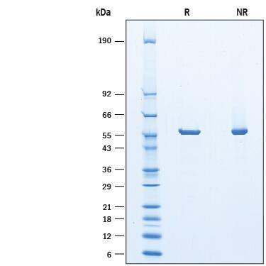 2 μg/lane of Recombinant Guinea Pig Asparaginase His-tag was  resolved with SDS-PAGE under reducing (R) and non-reducing (NR)  conditions and visualized by Coomassie® Blue staining, showing a band under reducing conditions at 57 kDa.