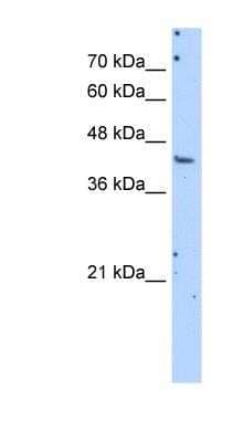 Western Blot: Aspartate Aminotransferase Antibody [NBP1-54778] - Titration: 1.0ug/ml, Positive Control: NCI-H226 cell lysate.