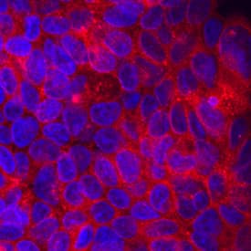 Attractin was detected in immersion fixed HepG2 human hepatocellular carcinoma cell line using Sheep Anti-Human Attractin Antigen Affinity-purified Polyclonal Antibody (Catalog # AF7238) at 10 µg/mL for 3 hours at room temperature. Cells were stained using the NorthernLights™ 557-conjugated Anti-Sheep IgG Secondary Antibody (red; Catalog # NL010) and counterstained with DAPI (blue). Specific staining was localized to cell membranes. View our protocol for Fluorescent ICC Staining of Cells on Coverslips.