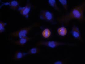 Aurora A was detected in immersion fixed HeLa human cervical epithelial carcinoma cell line using Goat Anti-Human Aurora A Biotinylated Antigen Affinity-purified Polyclonal Antibody (Catalog # BAF3295) at 5 µg/mL for 3 hours at room temperature. Cells were stained using the NorthernLights™ 557-conjugated Anti-Rabbit IgG Secondary Antibody (red; Catalog # NL004) and counterstained with DAPI(blue). Specific staining was localized to mitotic spindles. View our protocol for Fluorescent ICC Staining of Cells on Coverslips.