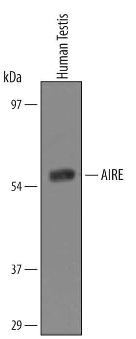 Western blot shows lysates of human testis tissue. PVDF membrane was probed with 1 µg/mL of Human Autoimmune Regulator/AIRE Antigen Affinity-purified Polyclonal Antibody (Catalog # AF5936) followed by HRP-conjugated Anti-Goat IgG Secondary Antibody (Catalog # HAF109). A specific band was detected for Autoimmune Regulator/AIRE at approximately 58 kDa (as indicated). This experiment was conducted under reducing conditions and using Immunoblot Buffer Group 8.