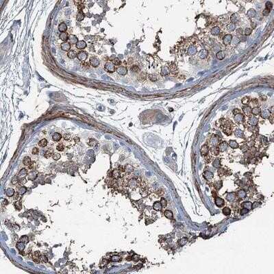 Immunohistochemistry-Paraffin: Axl Antibody [NBP1-83073] - Staining of human testis shows strong cytoplasmic positivity in cells in seminiferus ducts.