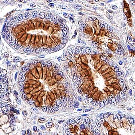     Axl  was detected in immersion fixed paraffin-embedded sections of human stomach  using Goat Anti-Human Axl Antigen Affinity-purified Polyclonal Antibody  (Catalog # AF154) at 3 µg/mL for 1 hour at room  temperature followed by incubation with the Anti-Goat IgG VisUCyte™  HRP Polymer Antibody (Catalog # VC004).  Tissue was stained using DAB (brown) and counterstained with hematoxylin  (blue).  Specific staining was  localized to plasma membranes of epithelial cells in gastric glands. View our  protocol for IHC  Staining with VisUCyte HRP Polymer Detection Reagents. 