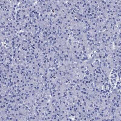 Azurocidin/CAP37/HBP Antibody (NBP3-16991): Novus Biologicals