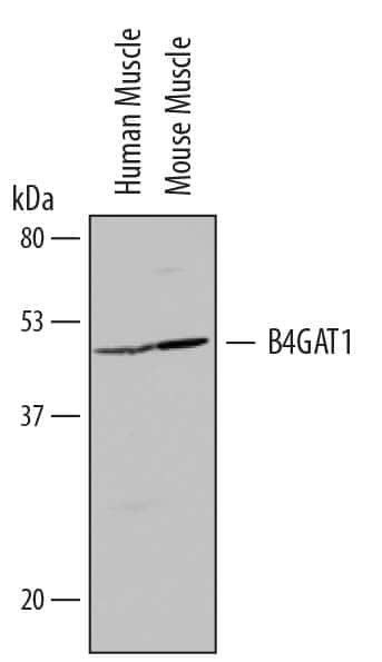 Western blot shows lysates of human muscle tissue and mouse muscle tissue. PVDF Membrane was probed with 1 µg/mL of Human  beta -1,4-Glucuronyltransferase 1/B4GAT1 Antigen Affinity-purified Polyclonal Antibody (Catalog # AF6664) followed by HRP-conjugated Anti-Sheep IgG Secondary Antibody (Catalog # HAF016). A specific band was detected for  beta -1,4-Glucuronyltransferase 1/B4GAT1 at approximately 50 kDa (as indicated). This experiment was conducted under reducing conditions and using Immunoblot Buffer Group 8.