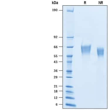 2 μg/lane of Recombinant Cynomolgus Monkey B7-2/CD86 His-tag (Catalog # 10300-B2) was  resolved with SDS-PAGE under reducing (R) and non-reducing (NR)  conditions and visualized by Coomassie® Blue staining, showing bands at 57-68 kDa.